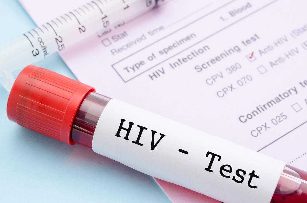 कैसे एचआईवी संचारित करने के लिए