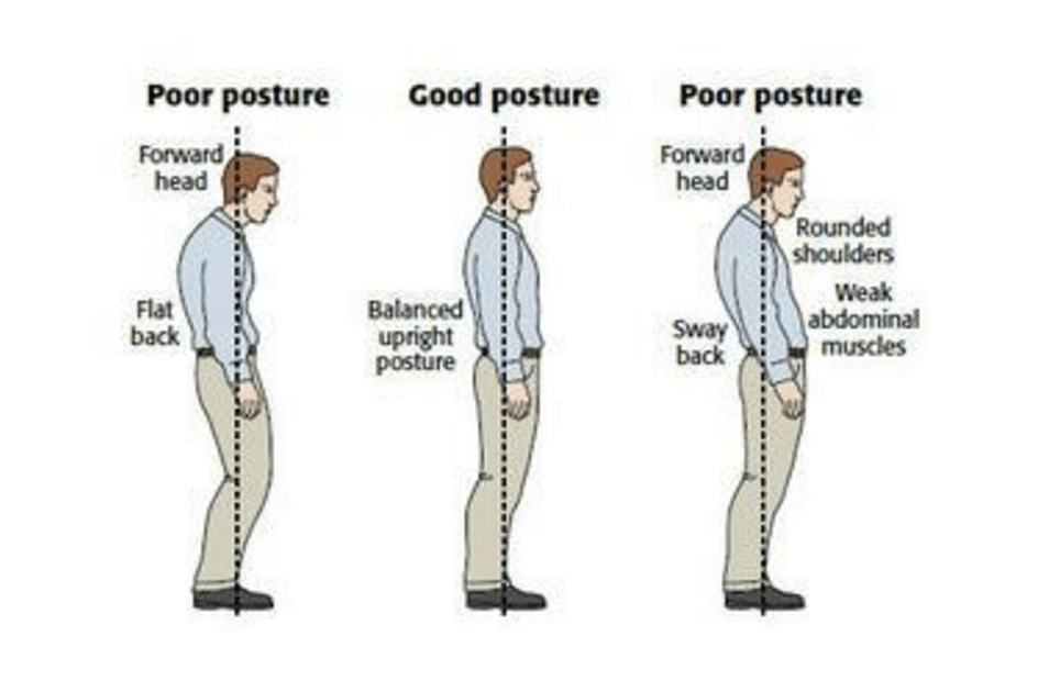 छवि स्रोत: http://www.thephysiocompany.com/blog/stop-slouching-postural-dysfunction-symptoms-causes-and-treatment-of-bad-posture
