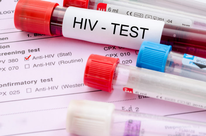 एचआईवी परीक्षण