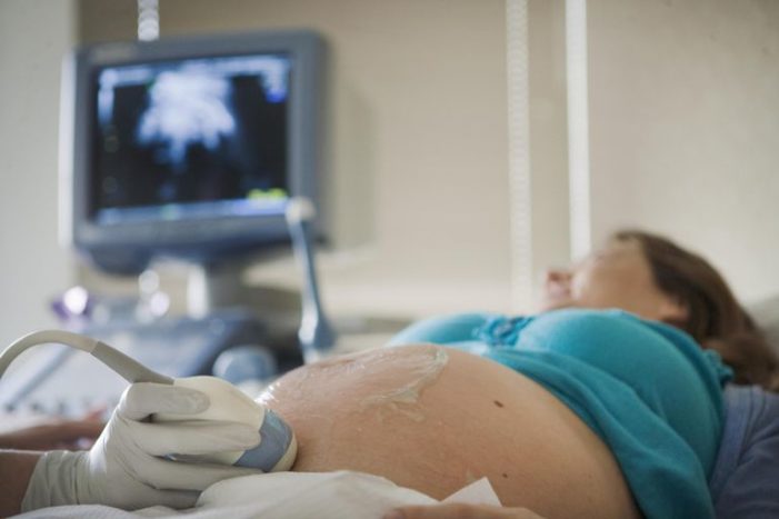 गर्भवती महिलाओं के लिए नॉनस्ट्रेस टेस्ट (NST)