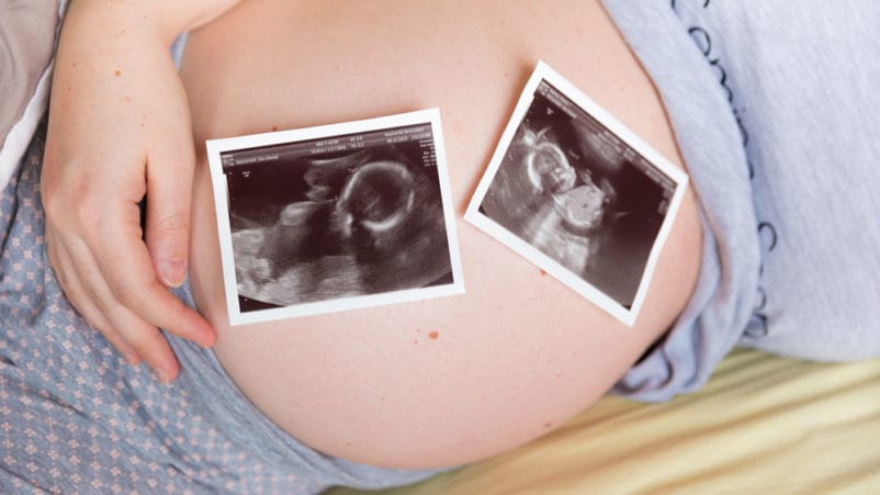 जुड़वा बच्चों के गर्भवती होने का जोखिम गायब हो जाता है