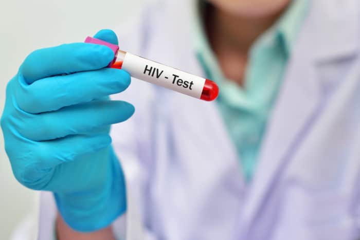एचआईवी रक्त परीक्षण